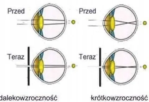 Ajurwedyjskie Okulary z dziurkami LECZĄCE WZROK oprawki korekcyjne