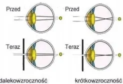 Ajurwedyjskie oprawki LECZĄCE WZROK korekcyjne