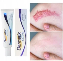 Dermatix Ultra Silikonowy Żel Do Leczenia i Zapobiegania Blizn 15g
