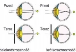 OKULARY AJURWEDYJSKIE LECZĄCE WZROK KOREKCYJNE