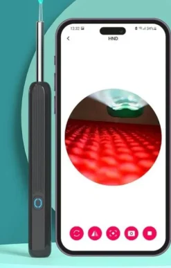 SMART OTOSKOP KAMERA CZYSZCZENIE USZU WOSK WIFI HD APLIKACJA ENDOSKOP